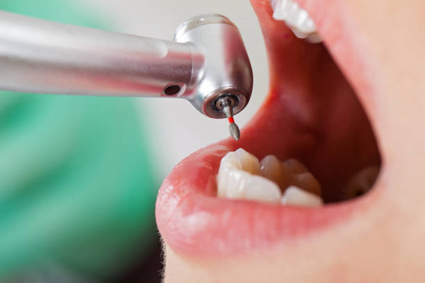 Best Pediatric Emergency Dentist in Powell, AL